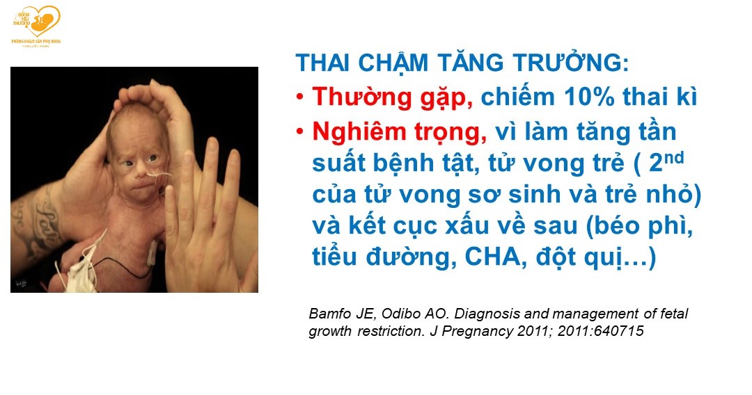 thai chậm tăng trưởng