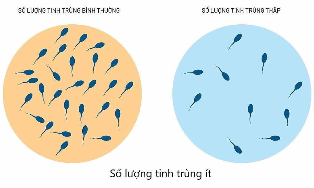 tinh trùng ít