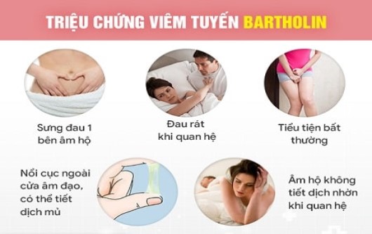 viêm tuyến bartholin có mang thai được không